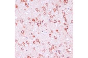 Immunohistochemistry of paraffin-embedded rat brain using RPL21 antibody (ABIN7269996) at dilution of 1:100 (40x lens). (RPL21 anticorps  (AA 1-160))