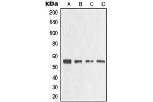 Western blot analysis of MMP3 expression in HeLa (A), A431 (B), mouse heart (C), PC12 (D) whole cell lysates. (MMP3 anticorps  (C-Term))