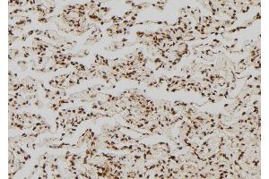 ABIN6267693 at 1/100 staining Human lung tissue by IHC-P.