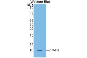 Detection of Recombinant IL6R, Rat using Polyclonal Antibody to Interleukin 6 Receptor (IL6R) (IL-6 Receptor anticorps  (AA 385-462))