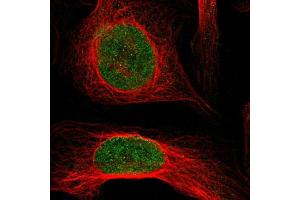 Immunofluorescent staining of U-2 OS cells using KAT5 polyclonal antibody  shows positivity in nucleus (green) but excluded from the nucleoli. (KAT5 anticorps  (AA 150-286))