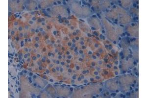 IHC-P analysis of Rat pancrease Tissue, with DAB staining. (IL2 Receptor beta anticorps  (AA 27-239))