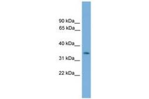 Image no. 1 for anti-NK3 Homeobox 2 (NKX3-2) (AA 151-200) antibody (ABIN6744516) (NKX3-2 anticorps  (AA 151-200))