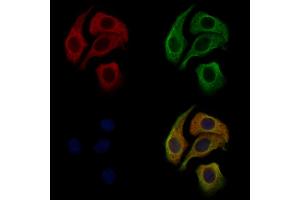 ABIN6264436 and ABIN6276677 staining Hela cells by IF/ICC. (PROC anticorps  (Internal Region))