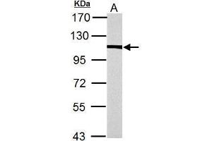 WB Image alpha Actinin 4 antibody [N2C1], Internal detects alpha Actinin 4 protein by Western blot analysis. (alpha Actinin 4 anticorps)