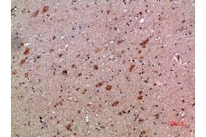 Immunohistochemical analysis of paraffin-embedded human-brain, antibody was diluted at 1:200