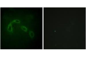 Immunofluorescence analysis of HeLa cells, using PAK1/2 (Ab-199) Antibody. (PAK1/2 anticorps  (AA 165-214))