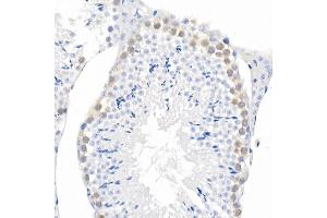 Immunohistochemistry of paraffin-embedded mouse liver using Phospho--S473 Rabbit mAb (ABIN6135179, ABIN6135970, ABIN6135971 and ABIN7101880) at dilution of 1:100 (40x lens). (AKT1 anticorps  (pSer473))