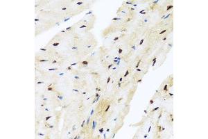 Immunohistochemistry of paraffin-embedded mouse heart using ZBTB17 antibody (ABIN5974597) at dilution of 1/100 (40x lens). (ZBTB17 anticorps)
