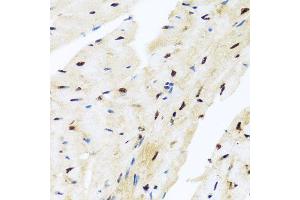 Immunohistochemistry of paraffin-embedded mouse heart using ZBTB17 antibody (ABIN5974597) at dilution of 1/100 (40x lens). (ZBTB17 anticorps)
