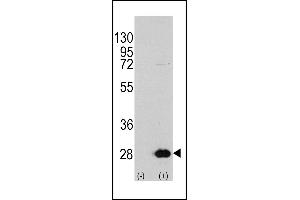 Western blot analysis of HSPB1 (arrow) using rabbit polyclonal HSPB1 Antibody (S78) (R). (HSP27 anticorps  (AA 56-85))
