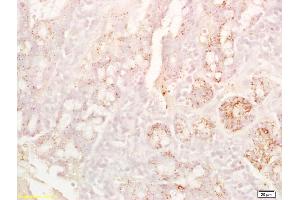 Formalin-fixed and paraffin embedded rat colon labeled with Anti-CD8B Polyclonal Antibody, Unconjugated (ABIN1387300) at 1:200 followed by conjugation to the secondary antibody and DAB staining.
