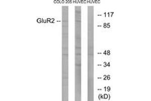 Western blot analysis of extracts from COLO205/HuvEC cells, using GluR2 (Ab-880) Antibody. (GRIA2 anticorps  (AA 834-883))