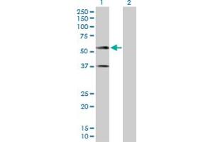 Western Blot analysis of CADM1 expression in transfected 293T cell line by CADM1 MaxPab polyclonal antibody. (CADM1 anticorps  (AA 1-387))