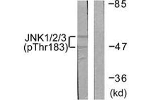 Western blot analysis of extracts from 293 cells treated with UV 5', using JNK1/2/3 (Phospho-Thr183+Tyr185) Antibody. (JNK anticorps  (pThr183))
