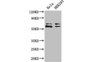 Western Blot Positive WB detected in: Hela whole cell lysate, HEK293 whole cell lysate All lanes: COASY antibody at 3. (COASY anticorps  (AA 453-546))