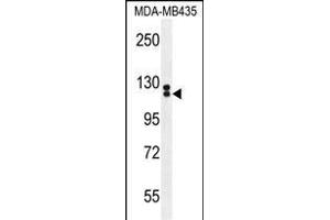 TTLL13 anticorps  (AA 461-490)