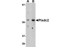 Western Blotting (WB) image for anti-Plexin Domain Containing 2 (PLXDC2) (N-Term) antibody (ABIN1031520) (PLXDC2 anticorps  (N-Term))