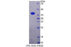 SDS-PAGE analysis of Mouse MRPL2 Protein.