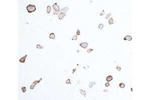 Immunocytochemistry (ICC) image for anti-Platelet Derived Growth Factor Receptor beta (PDGFRB) (AA 33-532) antibody (ABIN7453377)