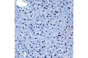 Immunohistochemistry of paraffin-embedded mouse pancreas using N Rabbit mAb (ABIN7268774) at dilution of 1:100 (40x lens). (NAT10 anticorps)