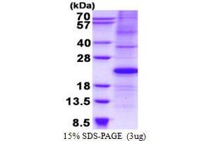 Image no. 1 for Cyclin-Dependent Kinase Inhibitor 1A (p21, Cip1) (CDKN1A) protein (His tag) (ABIN6387035)