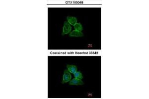 ICC/IF Image Immunofluorescence analysis of methanol-fixed A431, using Annexin A13, antibody at 1:500 dilution. (Annexin A13 anticorps  (N-Term))