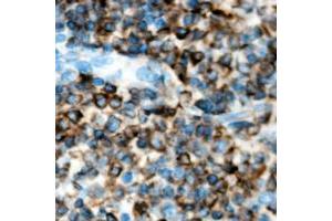 Immunohistochemical analysis of ACVR1B staining in human lymph node formalin fixed paraffin embedded tissue section. (Activin A Receptor Type IB/ALK-4 anticorps  (Center))