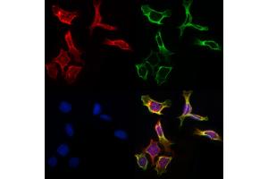 ABIN6261451 and ABIN6266860 staining Hela by IF/ICC. (Ephrin A5 anticorps  (Internal Region))