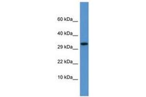 Image no. 1 for anti-Apolipoprotein F (APOF) (AA 175-224) antibody (ABIN6746096) (Apolipoprotein F anticorps  (AA 175-224))