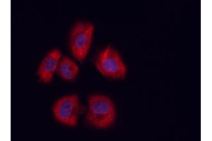 ABIN6258949 and ABIN6273453 staining U-2 OS cells by ICC/IF. (CD81 anticorps  (Internal Region))