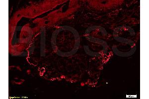 Formalin-fixed and rat pancreas tissue labeled with Anti-FN/Fibronectin 1 Polyclonal Antibody, Unconjugated (ABIN671646) at 1:200 followed by conjugation to the secondary antibody, Goat Anti-Rabbit IgG, PE conjugated