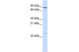 GPSM2 antibody used at 1 ug/ml to detect target protein. (GPSM2 anticorps)