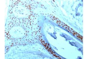 Formalin-fixed, paraffin-embedded human Skin stained with Nucleolin Mouse Monoclonal Antibody (NCL/902).