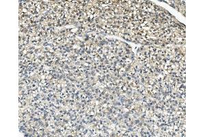 IHC analysis of AKR1D1 using anti-AKR1D1 antibody (ABIN7602975). (AKR1D1 anticorps  (Middle Region))