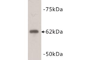 Western Blotting (WB) image for anti-PiggyBac Transposable Element Derived 5 (PGBD5) antibody (ABIN1854961) (PGBD5 anticorps)
