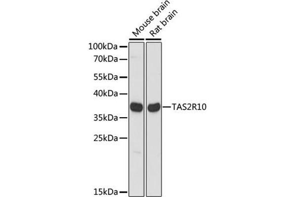 TAS2R10 anticorps  (AA 100-200)