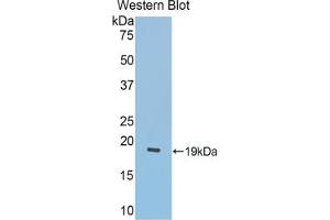 Western blot analysis of the recombinant protein. (LCAT anticorps  (AA 290-432))