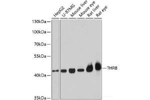 Western blot analysis of extracts of various cell lines using THRB Polyclonal Antibody at dilution of 1:1000. (THRB anticorps)