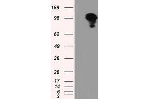 Image no. 3 for anti-Transforming, Acidic Coiled-Coil Containing Protein 3 (TACC3) antibody (ABIN1498099) (TACC3 anticorps)