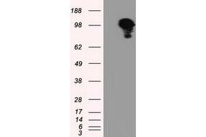 Image no. 3 for anti-Transforming, Acidic Coiled-Coil Containing Protein 3 (TACC3) antibody (ABIN1498099)