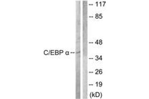 Western blot analysis of extracts from COS7 cells, treated with EGF 200ng/ml 30', using C/EBP-alpha (Ab-222) Antibody. (CEBPA anticorps  (AA 192-241))