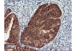 Image no. 5 for anti-Proteasome Subunit alpha 4 (PSMA4) antibody (ABIN1500459)