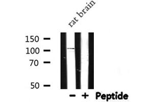 Western blot analysis of NOD1 expression in Rat brain lysate (NOD1 anticorps  (C-Term))