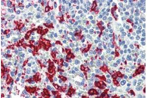 Human Spleen (formalin-fixed, paraffin-embedded) stained with HMOX1 antibody ABIN462095 at 10 ug/ml followed by biotinylated anti-mouse IgG secondary antibody ABIN481714, alkaline phosphatase-streptavidin and chromogen. (HMOX1 anticorps)