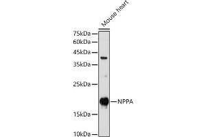 Western blot analysis of extracts of Mouse heart, using NPPA antibody (ABIN7268829) at 1:1000 dilution.
