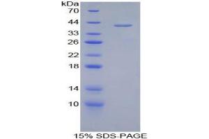 SDS-PAGE analysis of Human Corin Protein. (Corin Protéine)