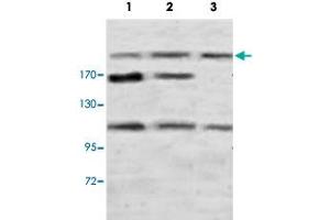 Western blot analysis of rat brain (Lane 1), rat testis (Lane 2) and human fetal kidney (Lane 3) lysate with PLXNB1 polyclonal antibody  at 1 : 500 dilution. (PLXNB1 anticorps  (N-Term))