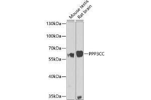 Western blot analysis of extracts of various cell lines, using PPP3CC antibody (ABIN6131416, ABIN6146099, ABIN6146100 and ABIN6223644) at 1:1000 dilution.