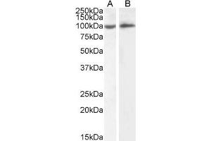 ABIN5539625 (2µg/ml) staining of HeLa (A) and Daudi (B) cell lysate (35µg protein in RIPA buffer). (ICAM1 anticorps  (Internal Region))